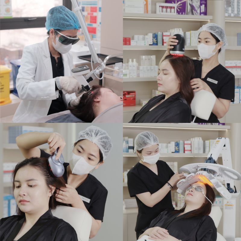 Meso Hair Therapy procedure at Sunwoo